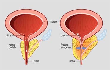 Haematology Test in Gandhinagar
