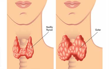 Haematology Test in Gandhinagar
