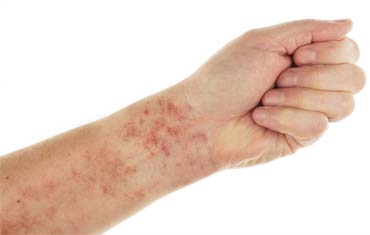lifestyle disorders hospital in gandhinagar