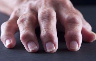 Lifestyle Disorders Services in Gandhinagar