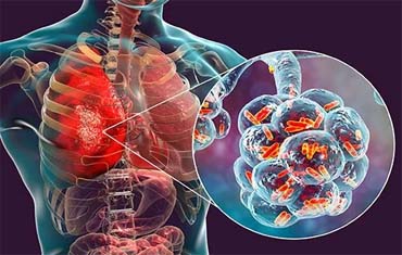 oncology doctor in gandhinagar