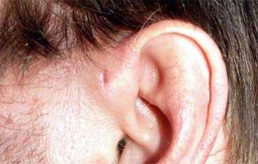 Lifestyle Disorders Services in Gandhinagar