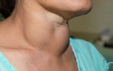 Hair Skin Treatment in Gandhinagar