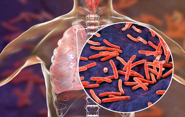 autoimmune treatment in gandhinagar