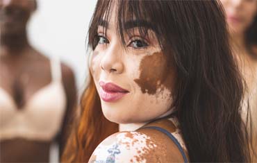 skin specialist in gandhinagar